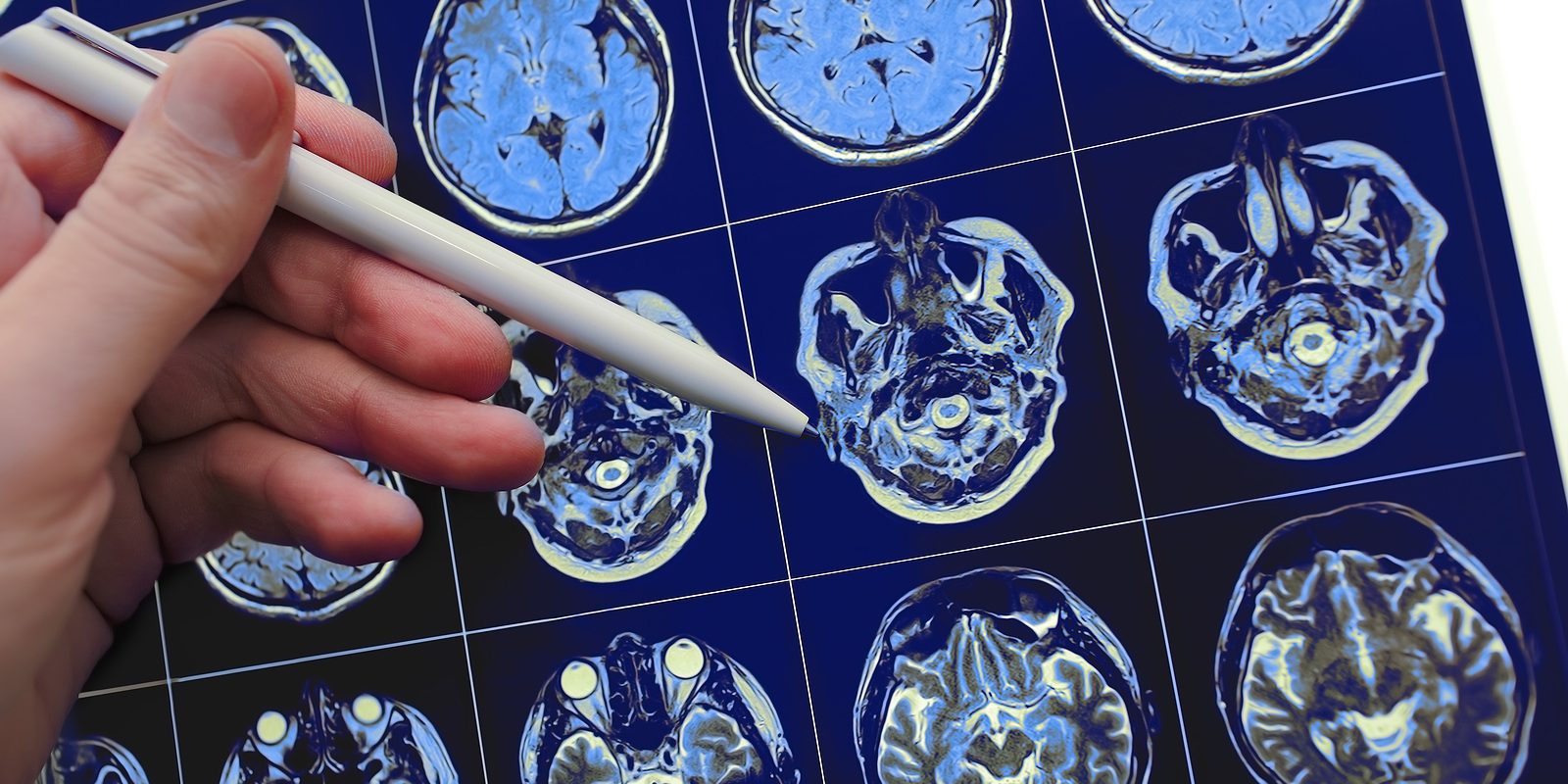 bigstock Medical Doctor Pointing With P 235190917