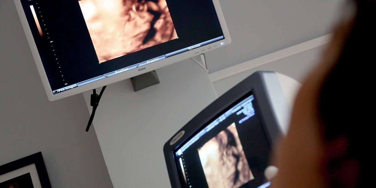 ultrasound display