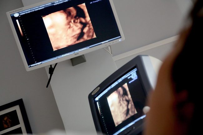 ultrasound display