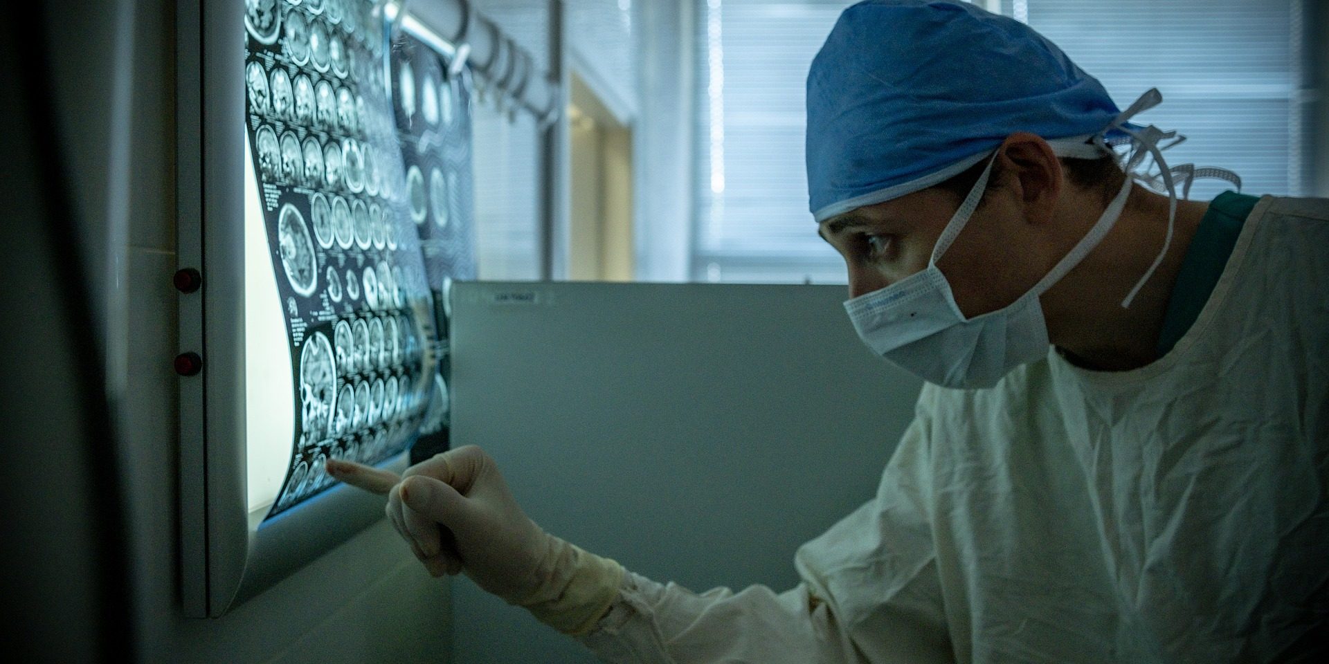 Doctor studies brain scans in medical office.