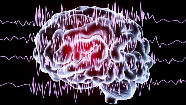 brain waves in epilepsy, illustration
