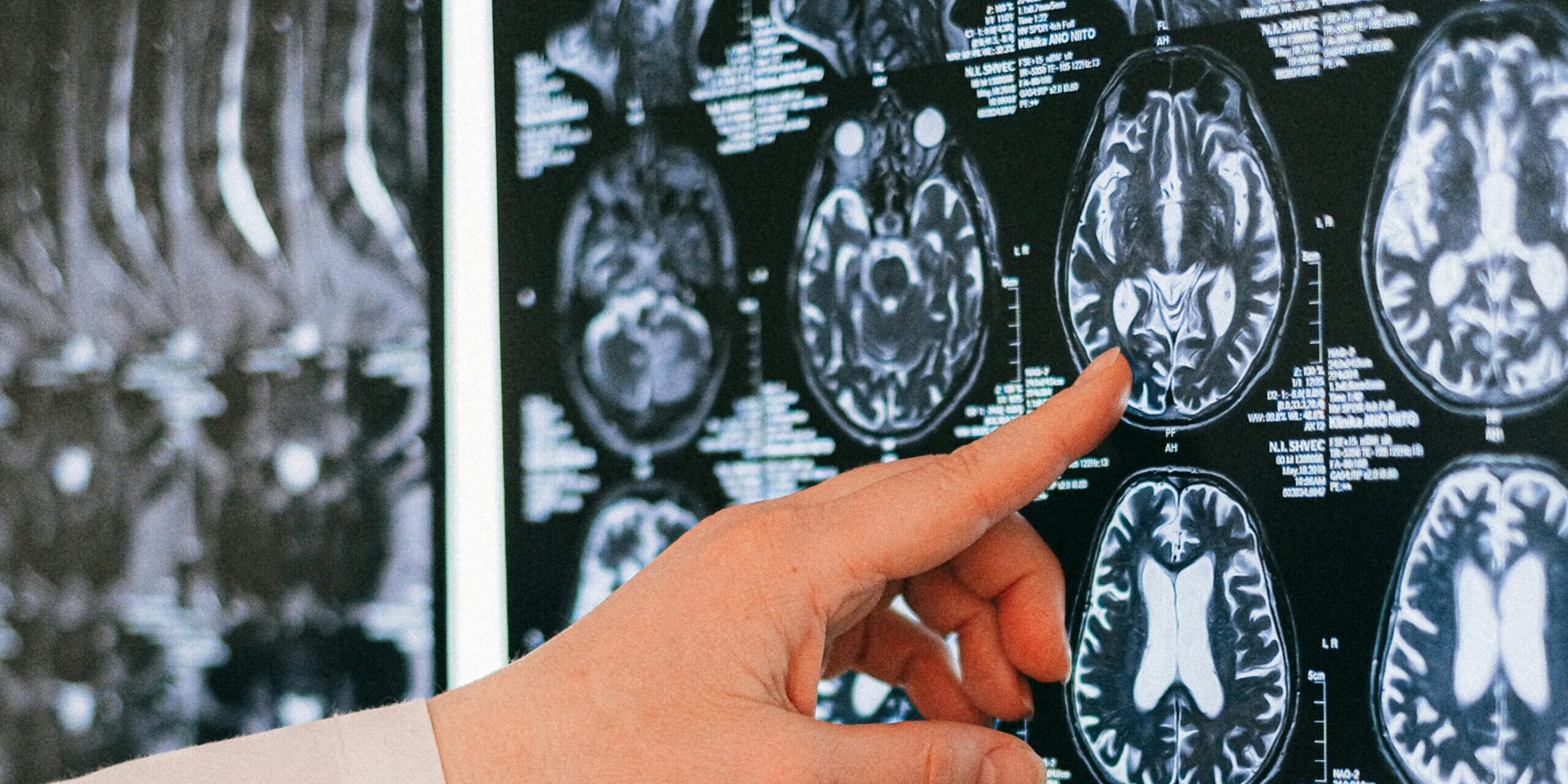 Hands pointing at a brain